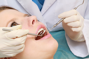 Dental Check-Ups